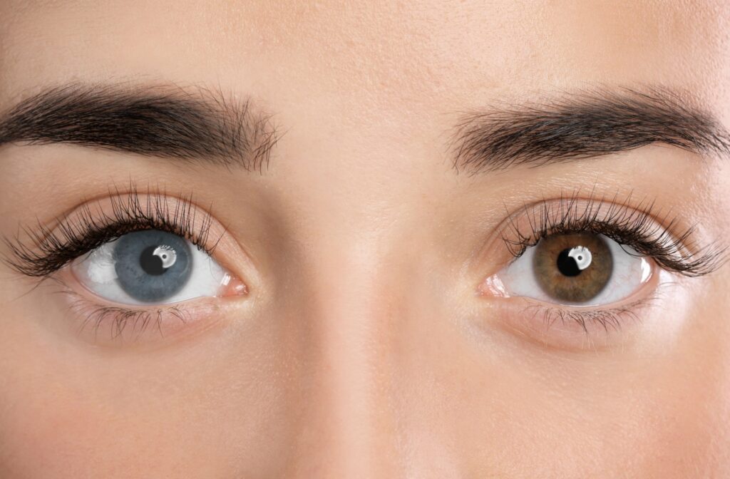 A close-up of two eyes with different colors, showing the effect of colored contact lenses
